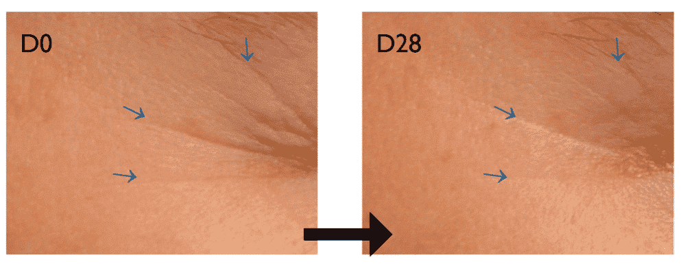 AKIŲ KONTŪRAVIMO GELIS