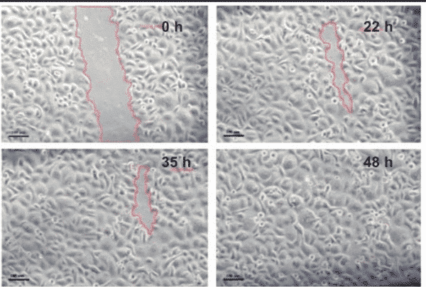 Microsection through cell culture of male keratinocytes